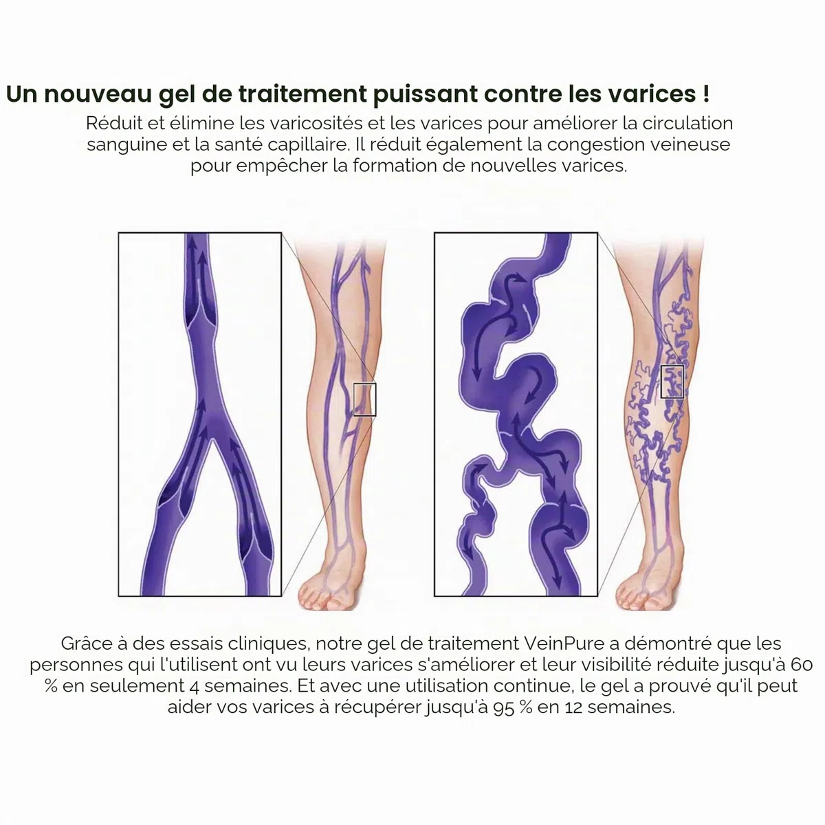 Crème anti-varices, anti-varices, anti-varicosités, soin doux des jambes, pour une bonne sensation dans les jambes, pommade de soin des jambes améliorant la circulation sanguine pour les jambes