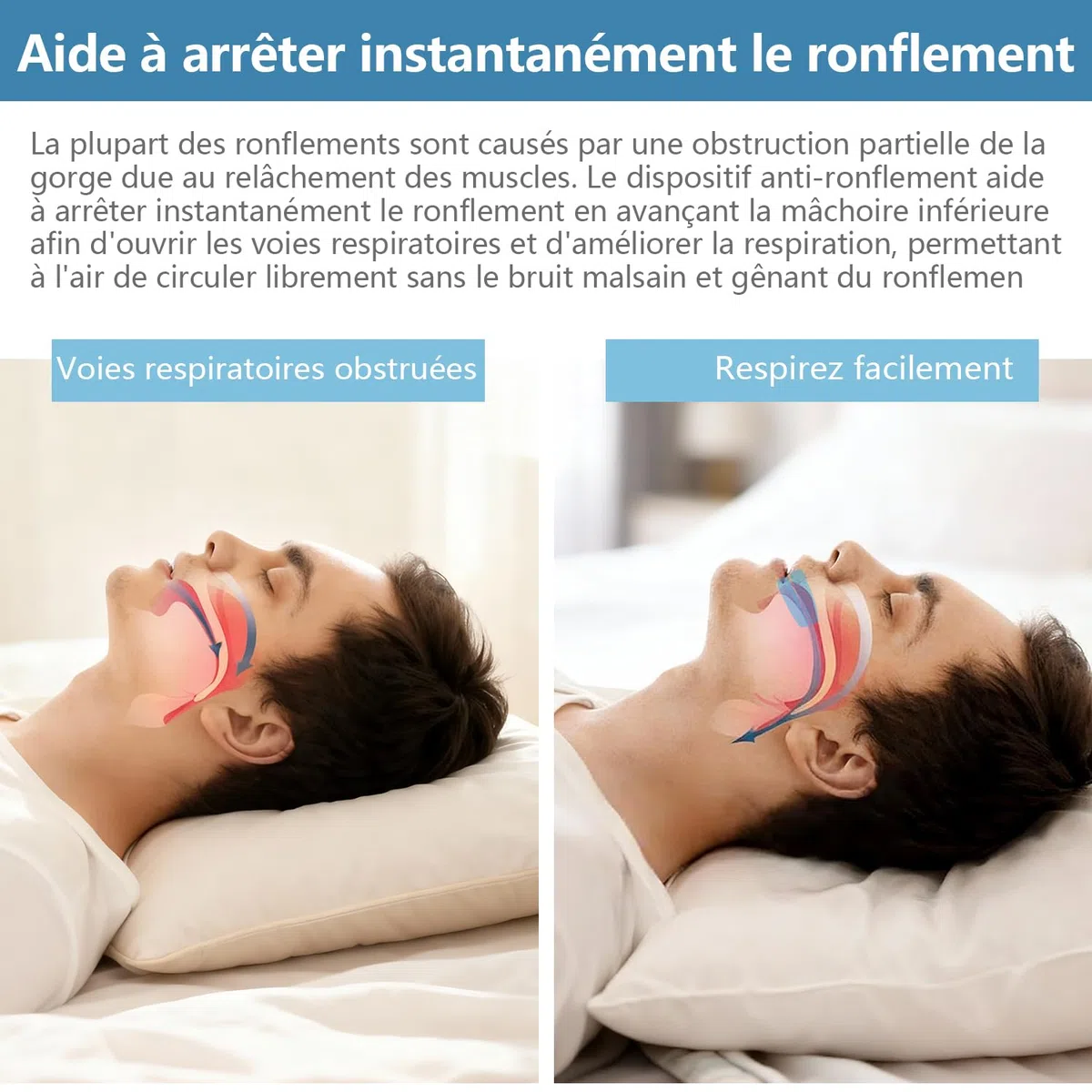 Anti Ronflement Orthese Inodore et Confortable Efficace Adapté Aux Hommes et Aux Femmes Ronflent Réutilisable (Transparent)
